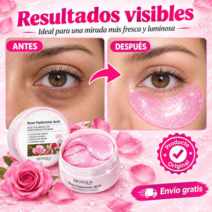 RoseGlow™ | Parches con rosas y ácido hialurónico que renuevan tu mirada
